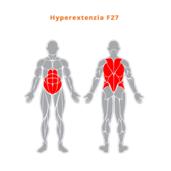 Hyperextenzia